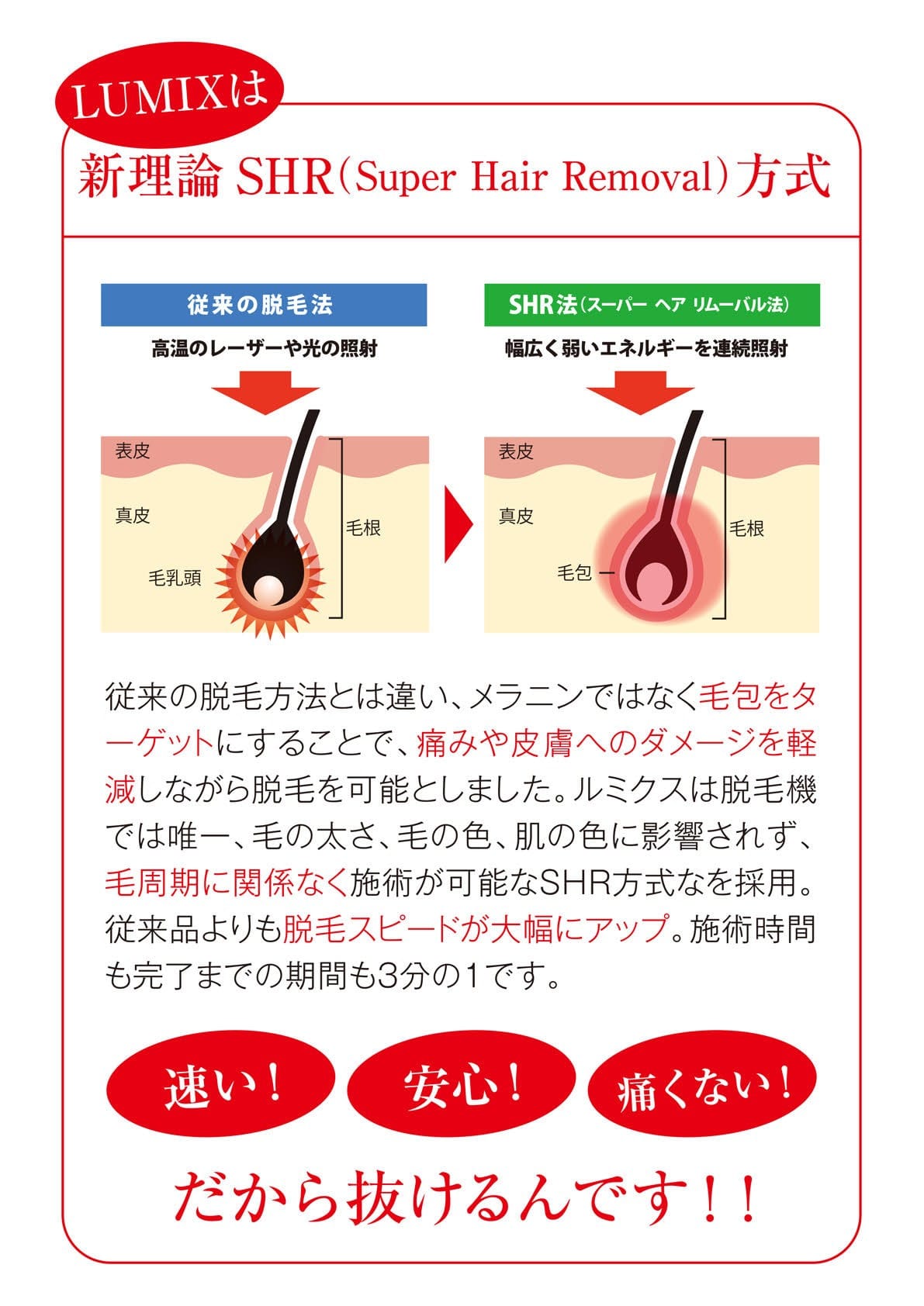 新理論SHR方式